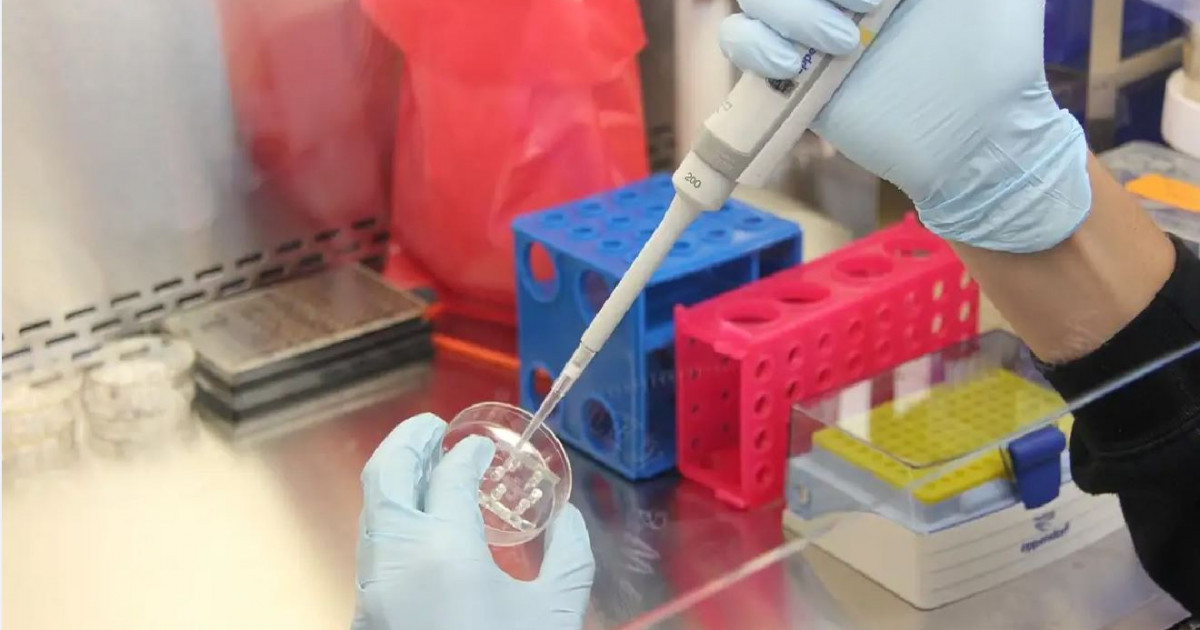 Күйдіргінің күйігі