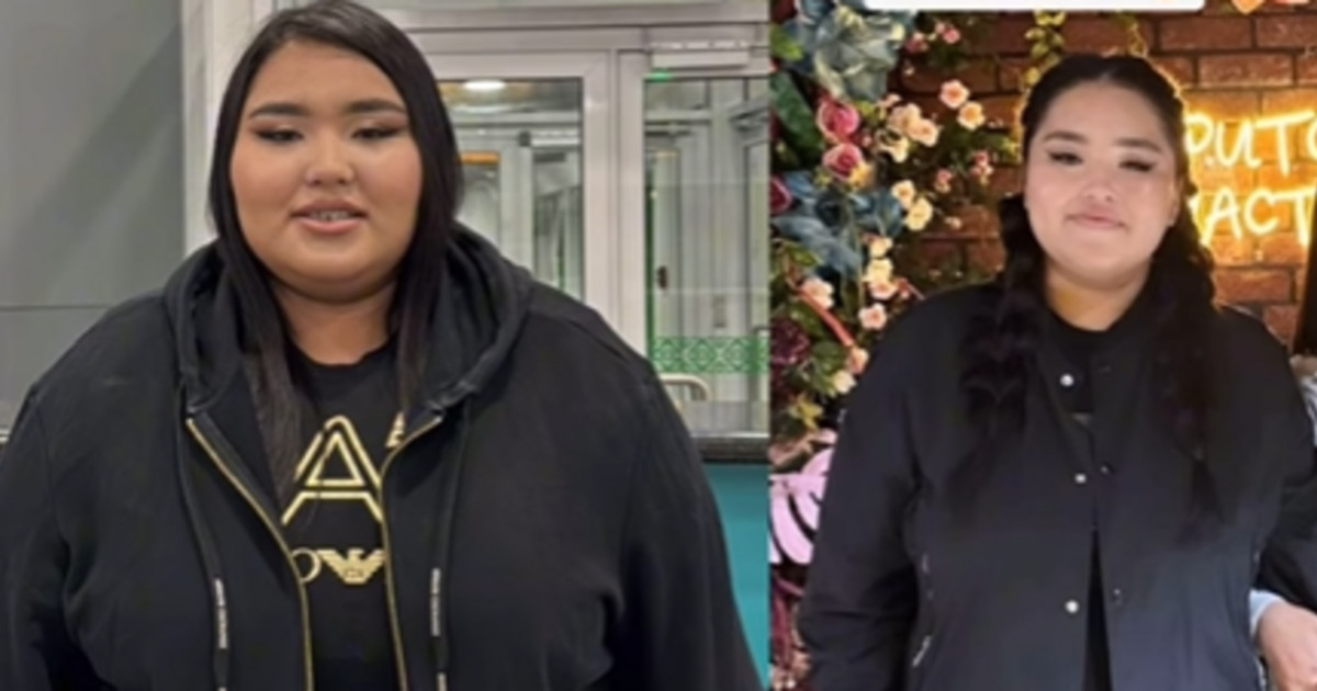 Асқазанына ота жасалған Айшолпан Тілеутай аз уақытта 40 келі салмақ тастады