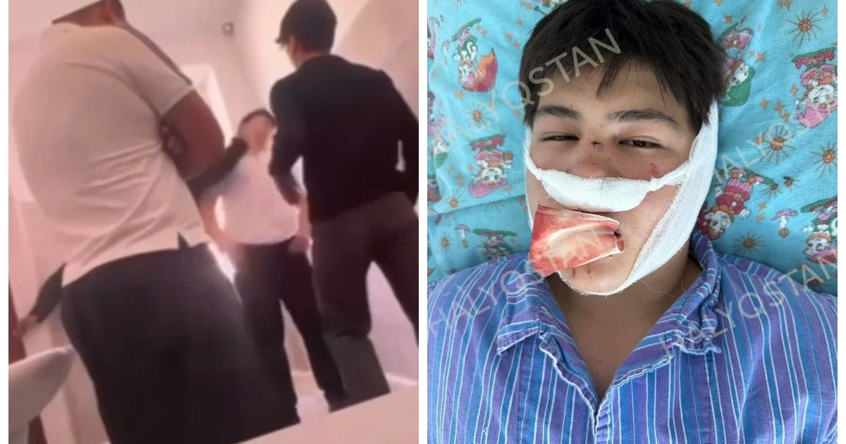 «Жағы мен мұрны сынған»: Қызылордадағы мектепте 10-сынып оқушысына алты бала жабылған