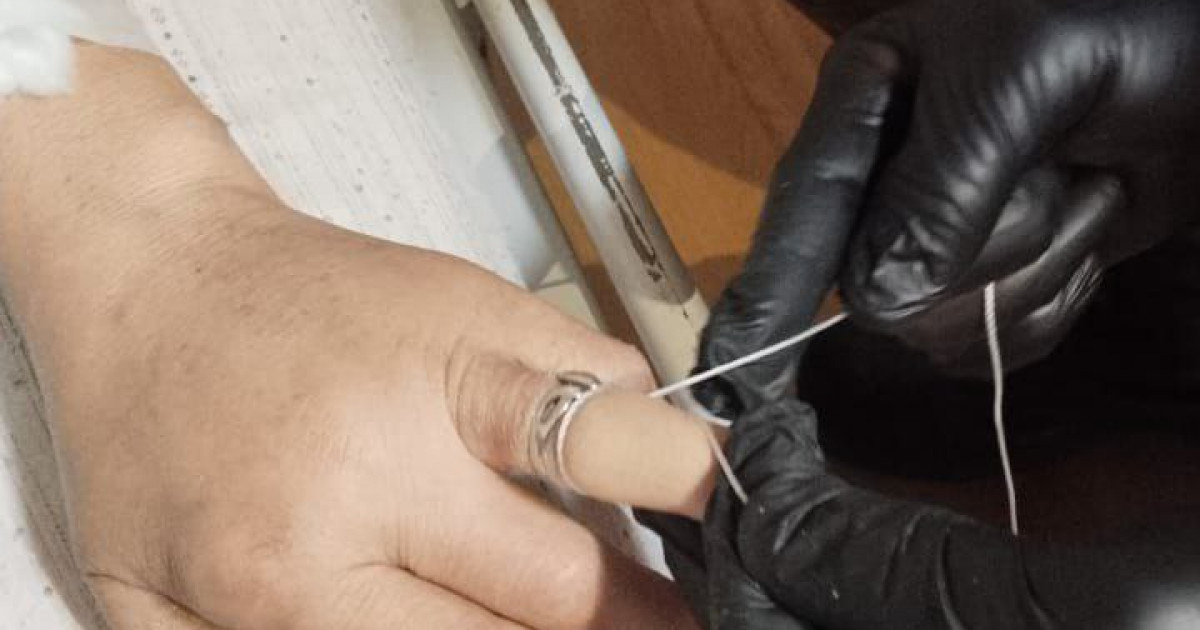 Талғарда әйел ісінген саусағындағы сақинаны шеше алмай, құтқарушыларды шақырды