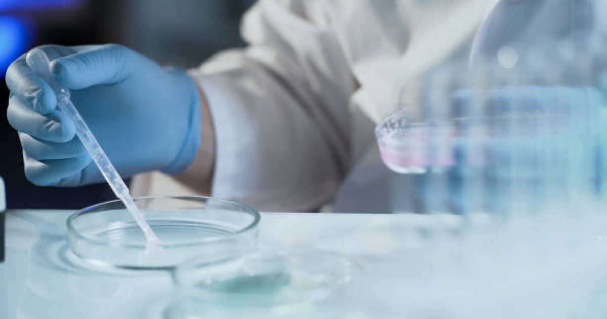 «Тәжірибемде өлімнен кейін «тіріліп кету» жағдайы болған...»: Қазақ патологоанатомы жұмыс барысын айтып берді