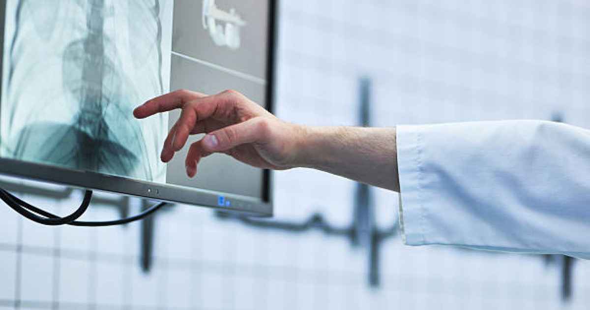 Қостанайда жоғалып кеткен ер адам өлі күйінде табылды